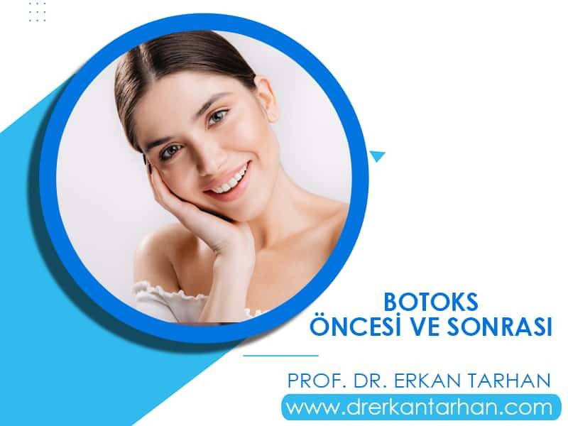 botoks-ile-genclestirme-oncesi-ve-sonrasinda-nelere-dikkat-edilmelidir-dr-erkan-tarhan