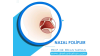 nazal-polipler-prof-dr-erkan-tarhan